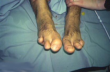 Name:  toes.jpg
Views: 523
Size:  44.7 KB