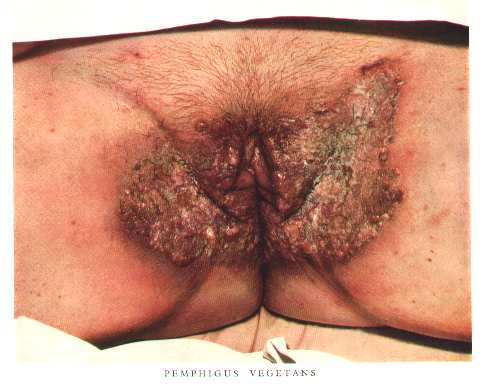 Name:  rotten.jpg
Views: 505
Size:  23.1 KB