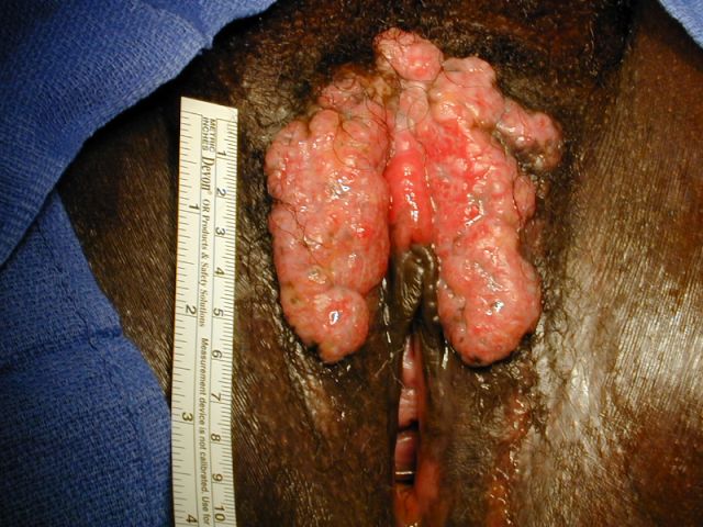 Name:  case200653gross.jpg
Views: 513
Size:  69.6 KB