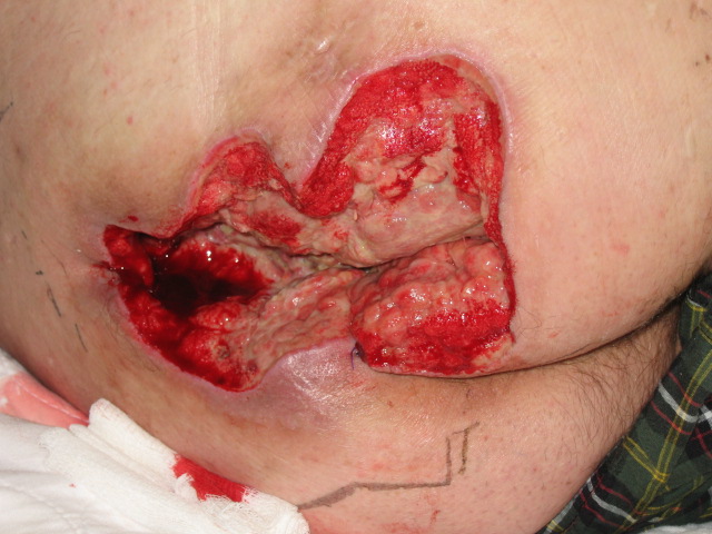 Name:  ass1.jpg
Views: 680
Size:  109.2 KB