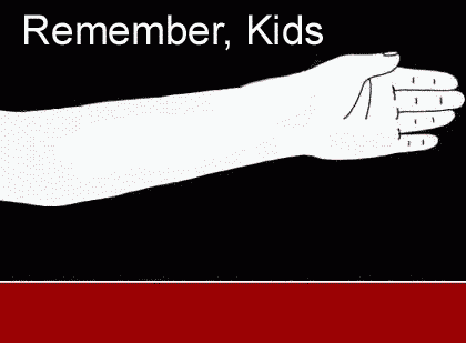 Name:  slit_wrist.gif
Views: 257
Size:  71.0 KB